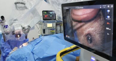 Procedimento cirúrgico inovador realizado na Santa Casa de Marília faz paciente de 22 anos recuperar a audição