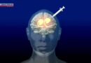 Seguro de saúde público do Japão cobrirá 1ª terapia celular com iPS para Parkinson do mundo