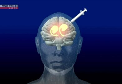 Seguro de saúde público do Japão cobrirá 1ª terapia celular com iPS para Parkinson do mundo